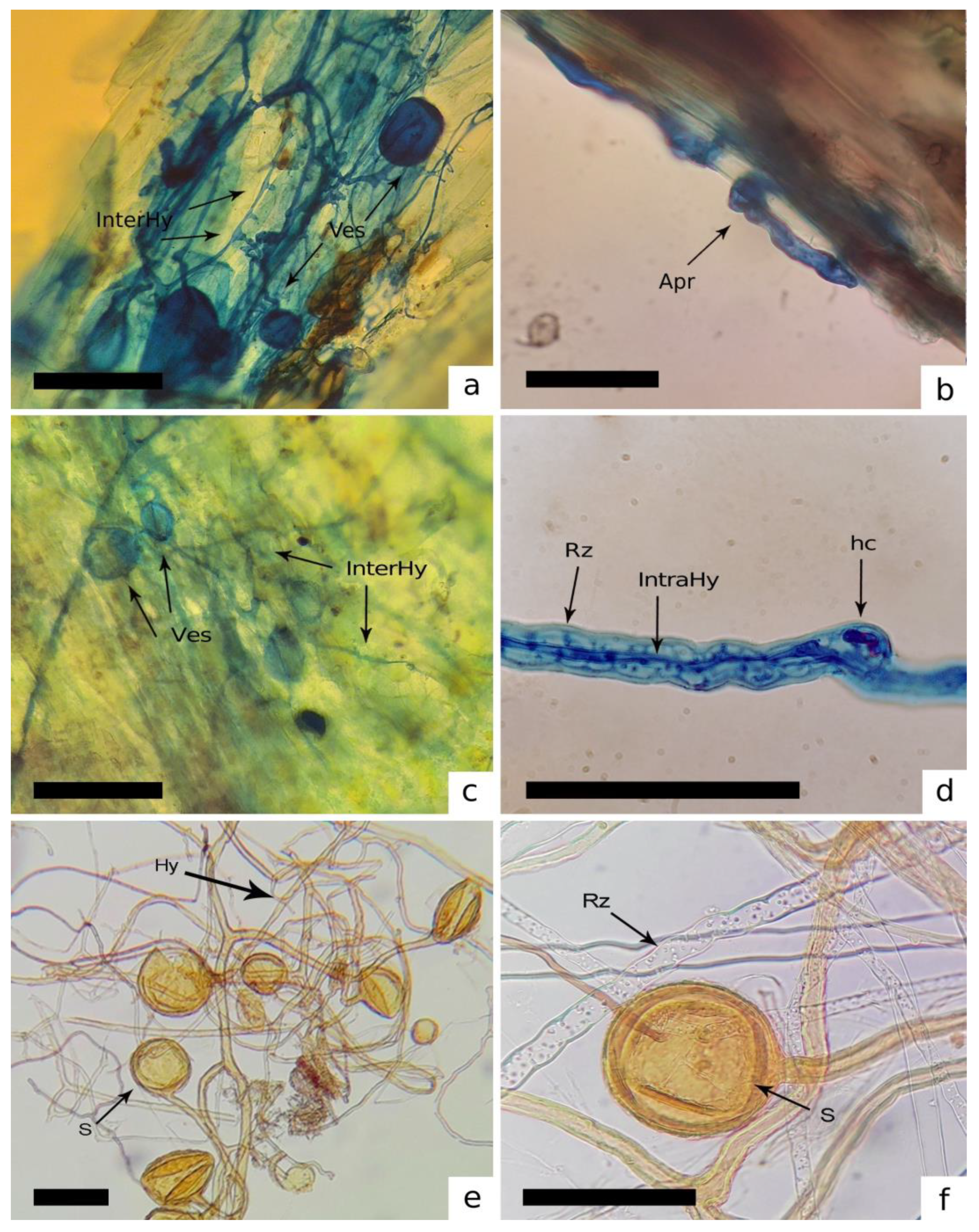 Inter- (InterHy) and intracellular (IntraHy) hyphae, vesicles (Ves), coils (hc) and spores (s) of AMF associated with mosses and liverworts.
